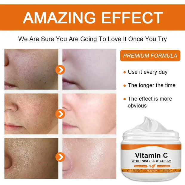 Vitamin C Face Cream: Dark Spot Removal & More