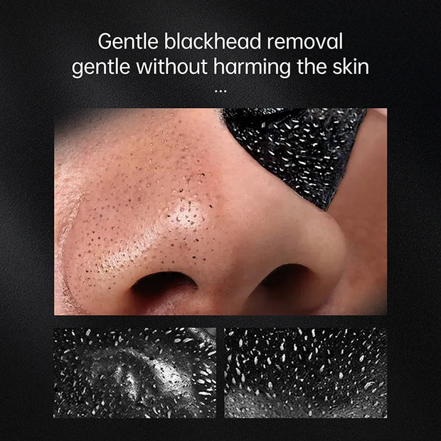AUQUEST Blackhead Remover Black Dots Facial Masks NoseBamboo Charcoal Point Pimple Anti Acne Spot Face Skin Care Beauty Health